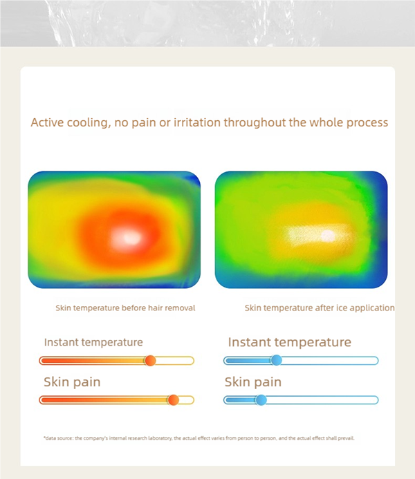 sapphire freezing point ipl hair removal device: painless, powerful & portable for at home use