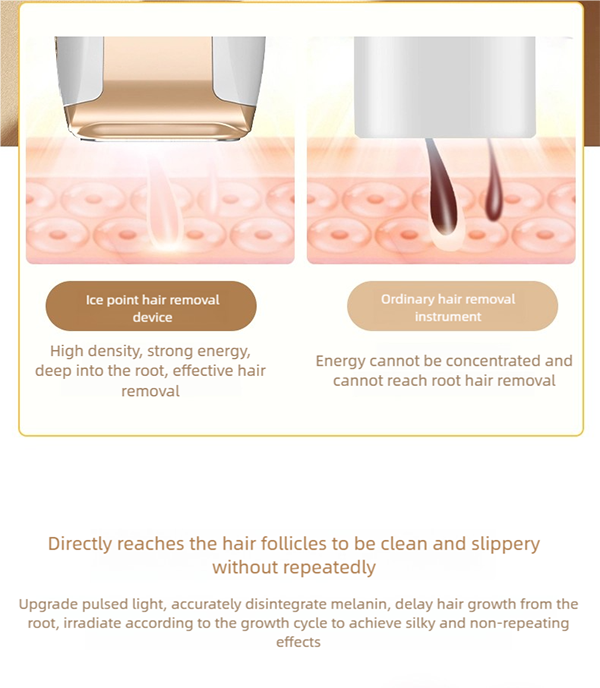 sapphire freezing point ipl hair removal device: painless, powerful & portable for at home use