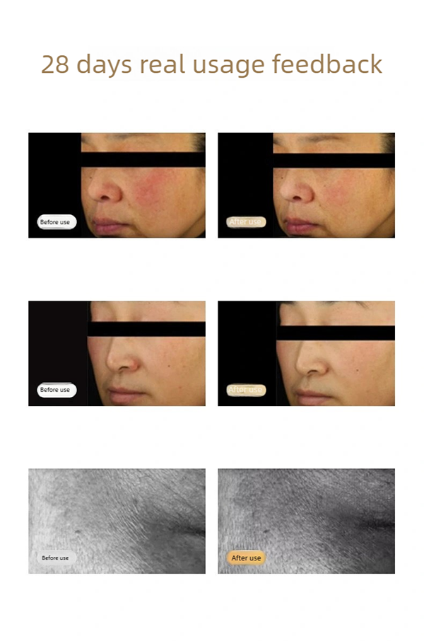 f2 upgraded led light therapy mask fda certified red & near infrared light facial mask for skin rejuvenation,brightening & barrier repair